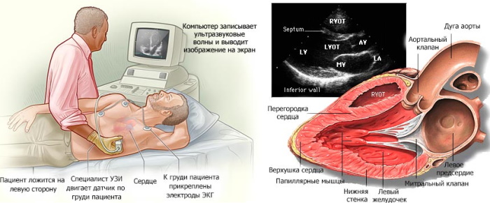 Эхокардиографии сердца у взрослых. Расшифровка, норма, таблица