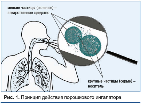 Ингалятор карманный для астматиков. Алгоритм применения, правила