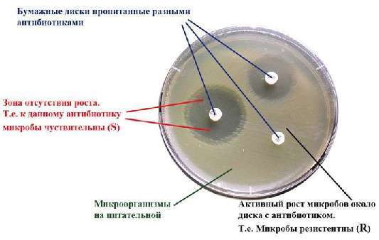 Как собрать мочу на бак посев на флору при беременности