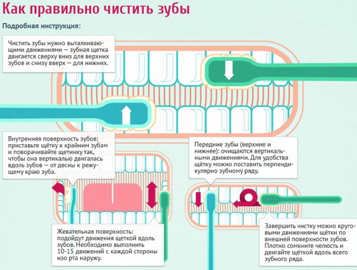 Как вылечить кариес без стоматолога у ребенка, подростка