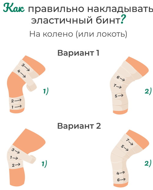 Как забинтовать колено эластичным бинтом