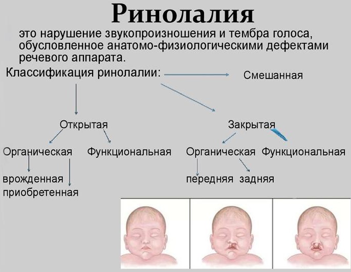 Классификация речевых нарушений: психолого, клинико педагогическая. Причины, виды