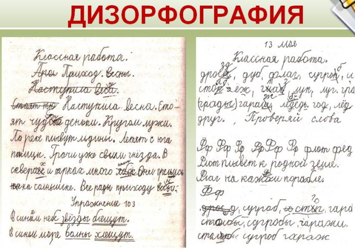 Классификация речевых нарушений: психолого, клинико педагогическая. Причины, виды