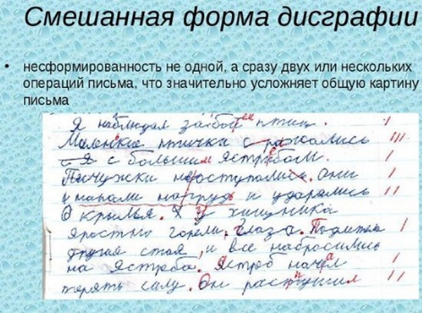 Классификация речевых нарушений: психолого, клинико педагогическая. Причины, виды