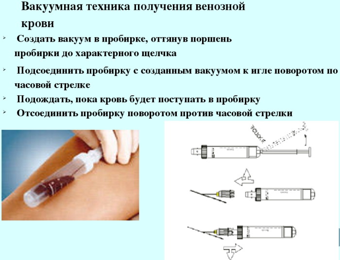 Клинический анализ крови. Расшифровка по распечатке, норма