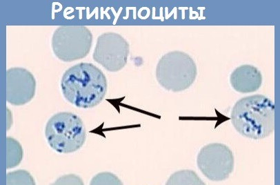 Клинический анализ крови. Расшифровка по распечатке, норма