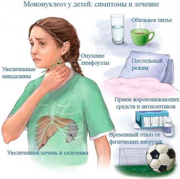 Мононуклеоз анализ крови: показатели, расшифровка, лечение