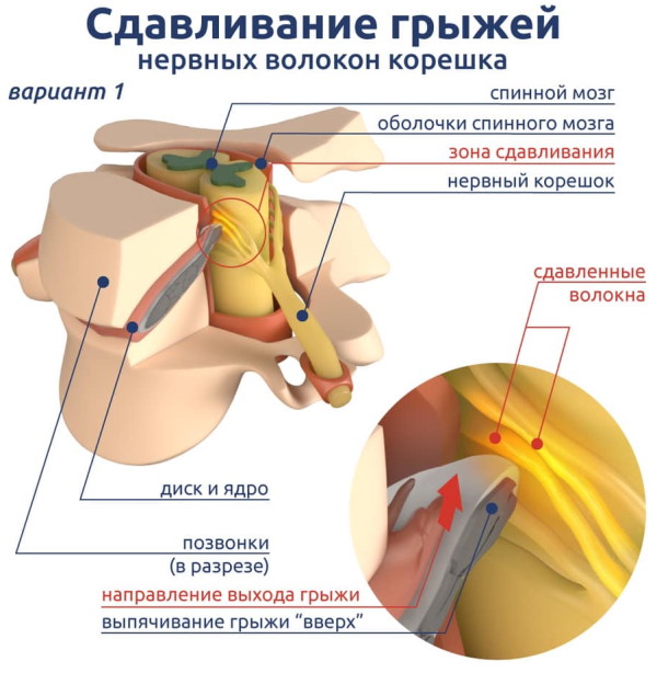 Невролог и невропатолог: разница, отличие, что лечит