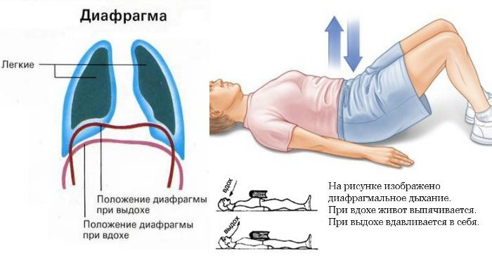 Рак голосовых связок фото