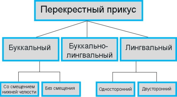 Перекрестный прикус, асимметрия лица. Фото, исправление брекетами