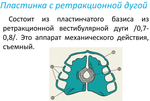 Пластины на зубы для детей для выравнивания. Цена, отзывы