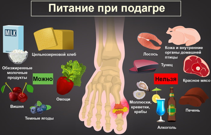 Подагра на ногах. Фото, лечение, таблетки, народные методы