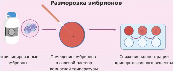 Подготовка к криопереносу эмбрионов в естественном цикле