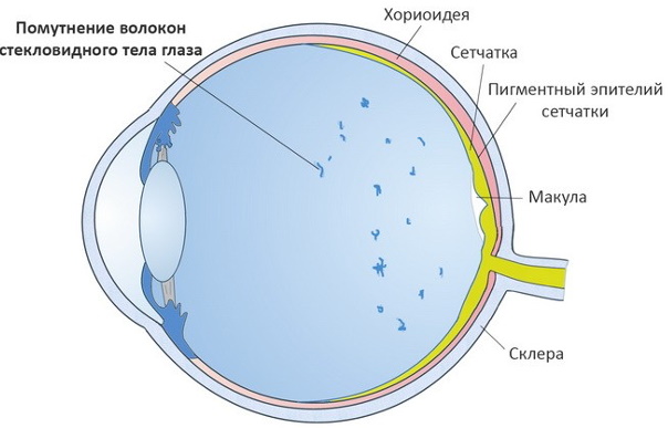 Рябит в глазах, мерцание. Причины и что делать