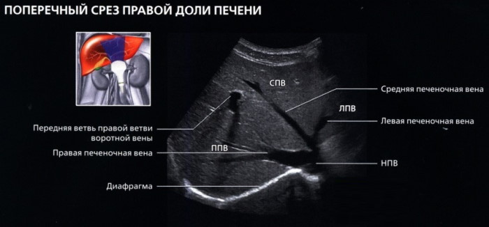 Сегменты сердца на узи схема