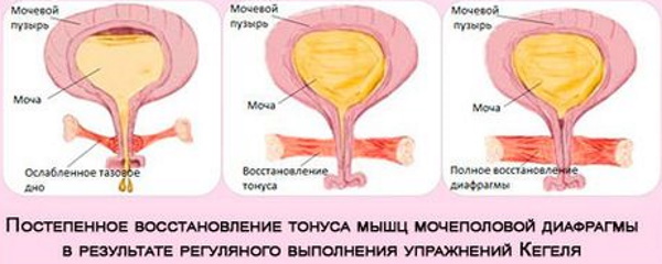 Тренировка мышц тазового дна для женщин