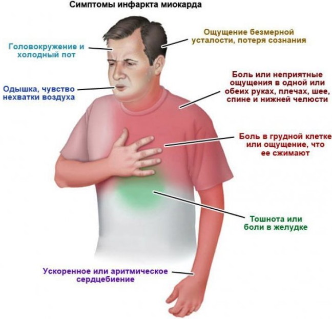 Инфаркт миокарда: что делать, первая помощь