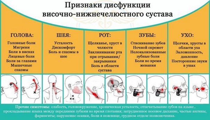 Дисфункция височно-нижнечелюстного сустава. Симптомы и лечение