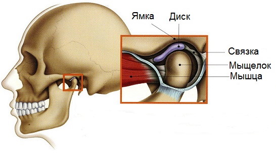 Дисфункция височно-нижнечелюстного сустава. Симптомы и лечение