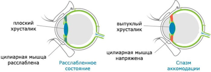 Двоится в глазах при взгляде вдаль. Причины