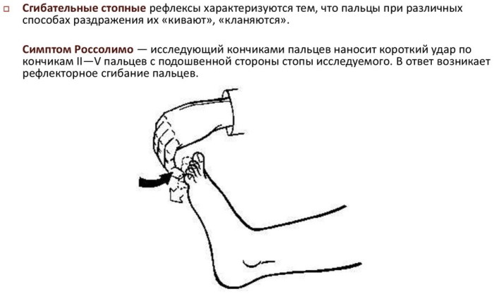 Горметония, горметонический синдром Давиденкова. Неврология