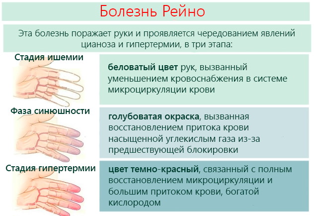 Немеет правая рука и нога одновременно. Причины у мужчин, женщин