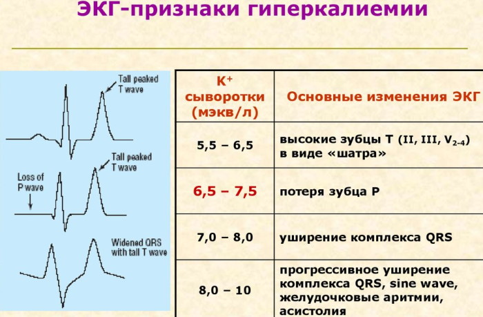 Избыток калия в организме у женщин. Симптомы после 40-50-60 лет, лечение