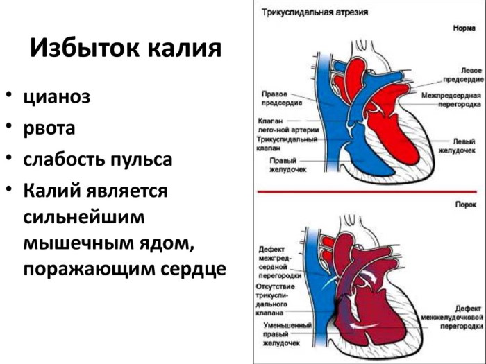 Избыток калия в организме у женщин. Симптомы после 40-50-60 лет, лечение