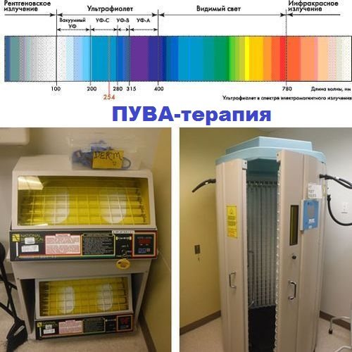 Лечение витилиго: препараты, витамины, мази, УФ-лампа, лазер. Отзывы