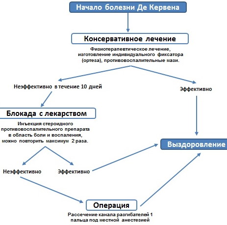 Синдром Де Кервена. Лечение медикаментозное, лазером, Дарсонваль