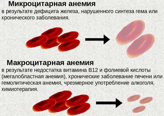 Средний объем эритроцита MCV повышен у женщин, мужчин