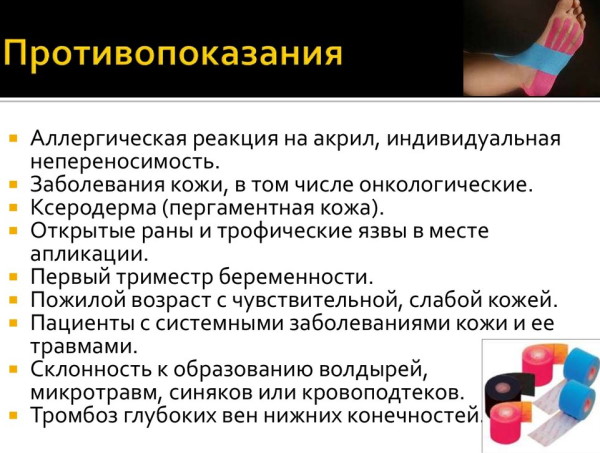 Тейпирование при вальгусной деформации стопы у детей. Схема