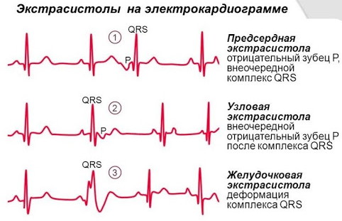 Толчки, сильно бьется сердце в состоянии покоя. Причины, что делать