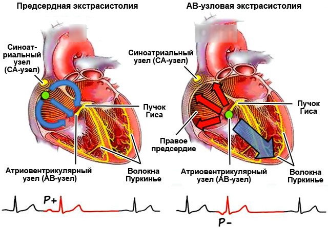 Толчки, сильно бьется сердце в состоянии покоя. Причины, что делать