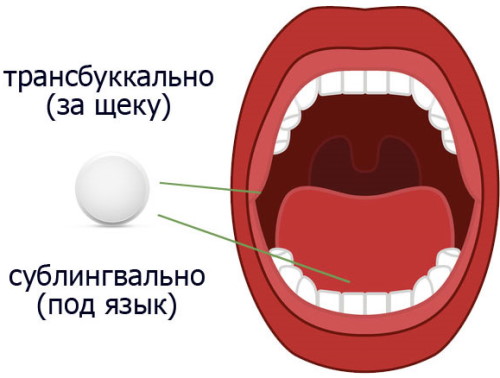 Что означает слово трансбуккально при приеме таблеток