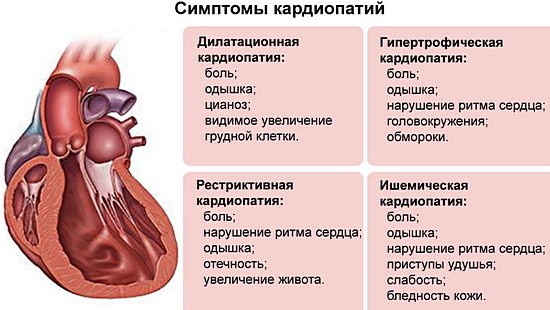 Тяжесть слева под ребрами после еды спереди, сбоку, сзади