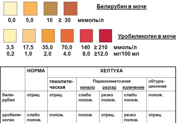 Уробилиноген в моче 34 у женщин что означает