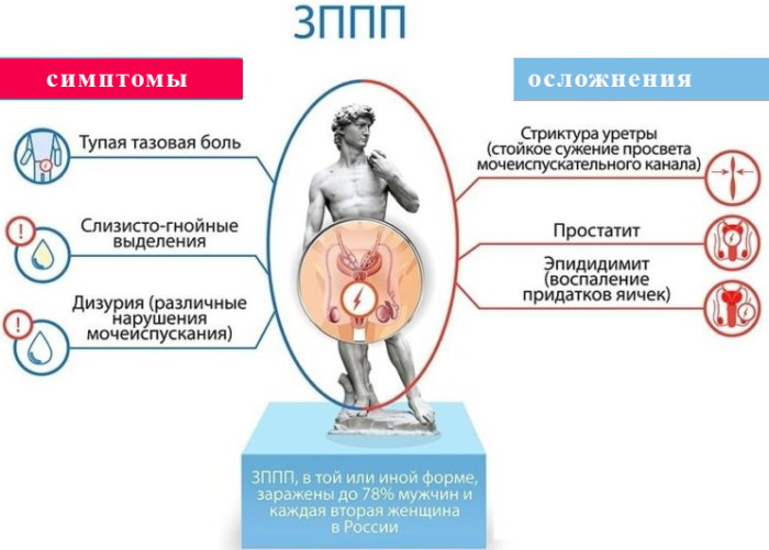 Анализы на ЗППП для мужчин. Перечень, какие и как сдавать