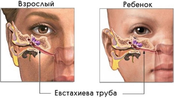 Болит горло и закладывает уши, нос, температура. Причины