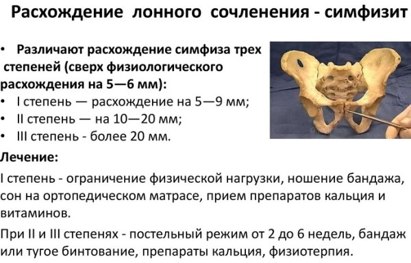 Болит лобок при беременности. Почему сильно болит по неделям