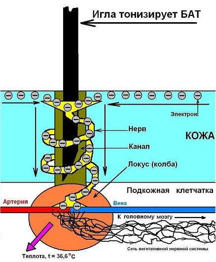 Иглорефлексотерапия. Показания и противопоказания