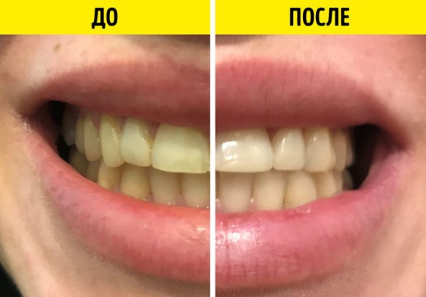 Как почистить зубы кокосовым маслом. Смотреть фото Как почистить зубы кокосовым маслом. Смотреть картинку Как почистить зубы кокосовым маслом. Картинка про Как почистить зубы кокосовым маслом. Фото Как почистить зубы кокосовым маслом