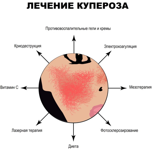 Капилляры на лице. Как убрать аптечными средствами, мазь, таблетки