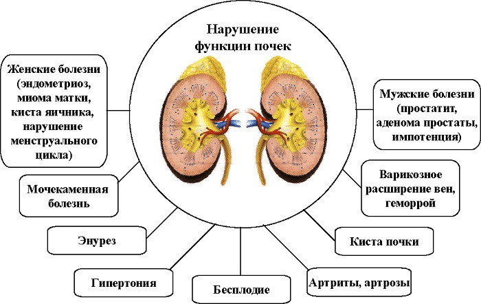 Лечение почек народными средствами. Самые эффективные средства