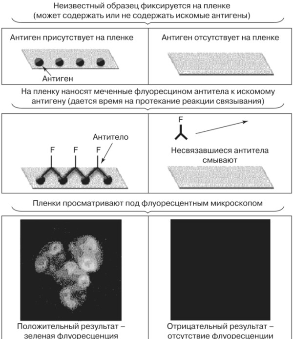 Псевдотуберкулез и иерсиниоз. Дифференциальная диагностика