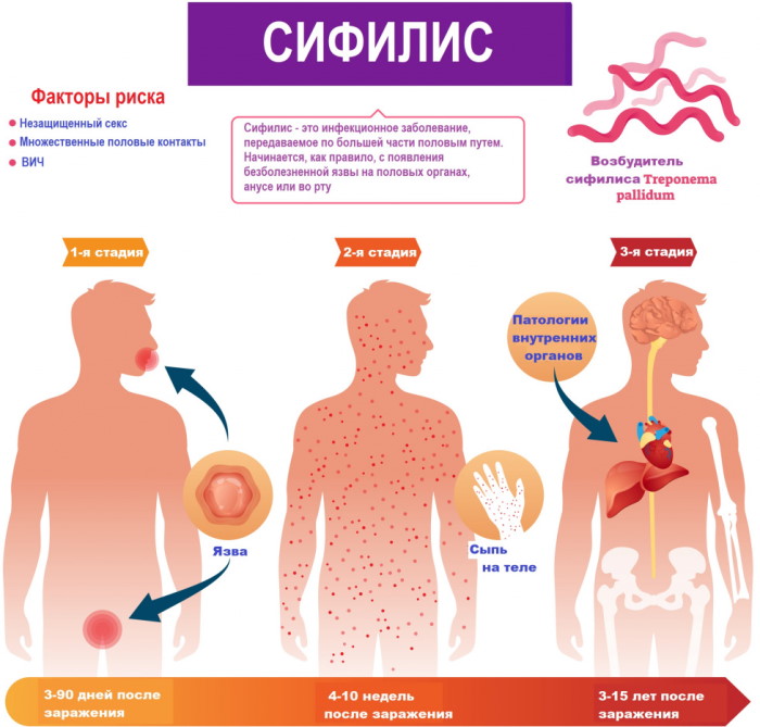 Сифилис на лице. Фото высыпаний, как выглядит