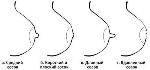 Соски у женщин. Виды ареол, какие бывают формы