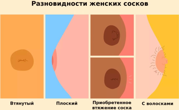 Соски у женщин. Виды ареол, какие бывают формы