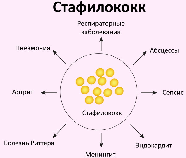 Фото стафилококк ауреус