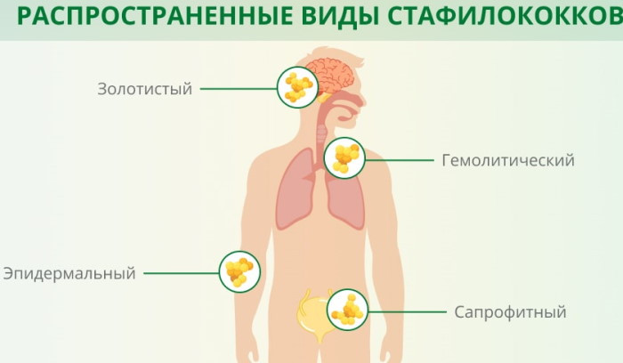 Стафилококк Ауреус (staphylococcus aureus): норма в мазке из зева, 10 в 3-8 степени